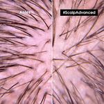 SHAMPOO-SCALP-ADVANCED-ANTI-MALESTAR-LOREAL-PROFESSIONNEL