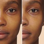 80095973_benefitresults_1_blind
